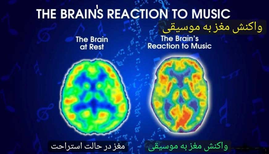 فواید موسیقی برای مغز